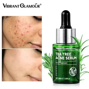 2022 New Tea Tree Acne Treatment Serum Remove Acne Spots Oil Control Shrink Pores Repair Whitening Moisturizing Essence