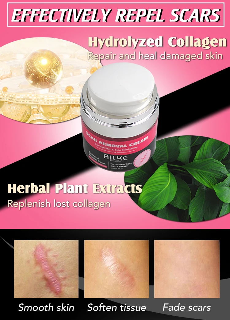 Strong Effective Acne Scar Removal Cream Smoothing Firming New Scars
