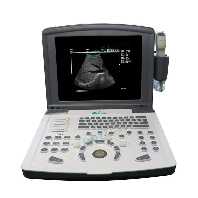 MEDIGE UMKR12 China Good Price Hospital Clinic Laptop Ecografos Instruments Medical Black White B/W Ultrasound Machine Portable-121057