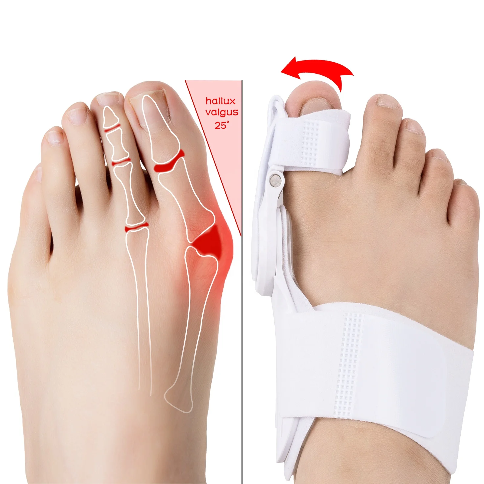 Выпрямитель большого пальца. Бандаж-шина Bunion Aid Hinged Splint for Bunions корректор большого пальца. Корректор разделитель для пальцев вальгусная шина. Выпрямитель большого пальца на ноге. Шина на ногу.