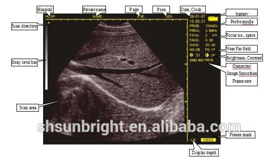 Mobile Handheld Vet Ultrasound Machine Veterinary Ultrasound Ultrasonido Portatil