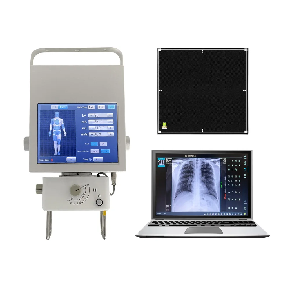 High Quality Portable X-Ray Machine 5kw  Xray Machine Imaging for Orthopedics, Chest, Lumbar Spine