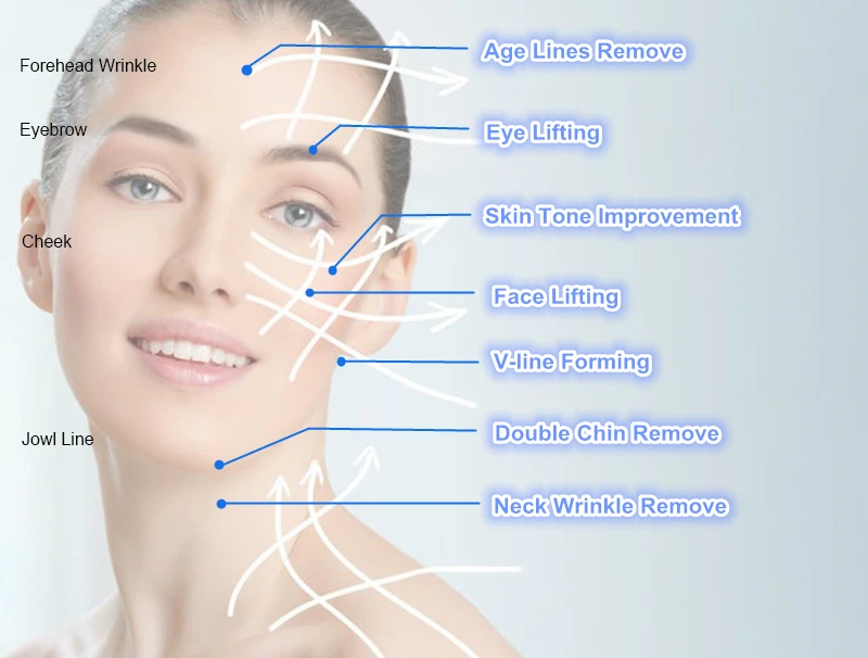 2024 professional anti aging anti-wrinkle machine Face Lift face firming Wrinkle Remover smas mfu rf skin beauty salon machine