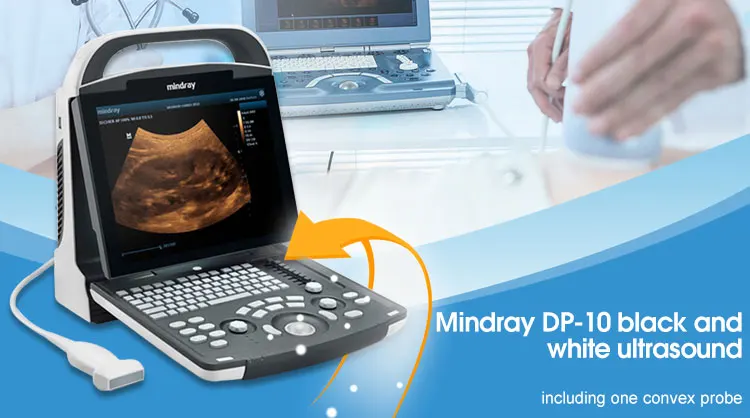 Mindray Dp-10 Ultrasound Full Digital Ultrasonic Diagnostic Imaging ...