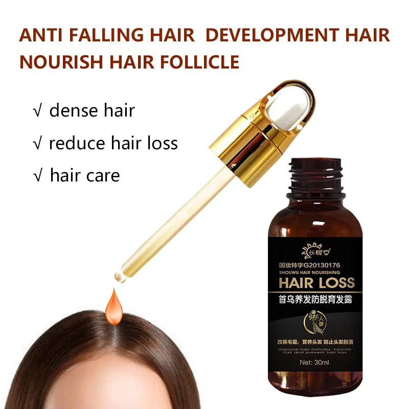 Oem/odm Anti Hair Loss Products Natural Extract Germinal Essential Oil Hair  Growth - Buy Instant Hair Growth,China Hair Growth Oil,Hair Loss Product on  