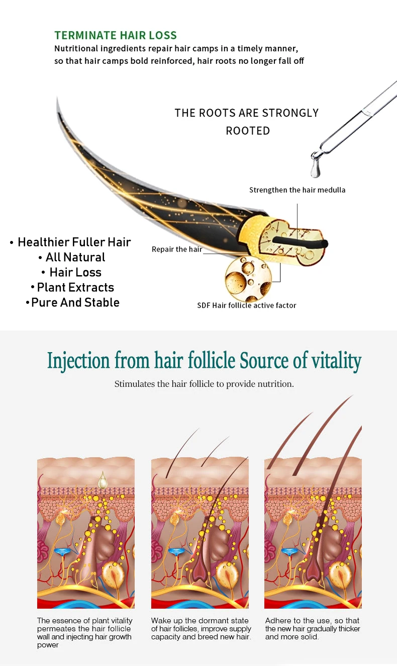 New Original Anti Hair Loss Treatment Fast Hair Growth Serum for Damage Hair