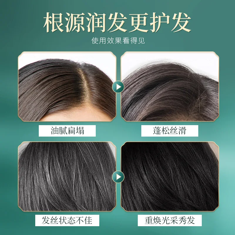 Selling Beauty Doctor Black Ganoderma and Polygonum Multiflorum Shampoo for Oil Control and Mite Prevention