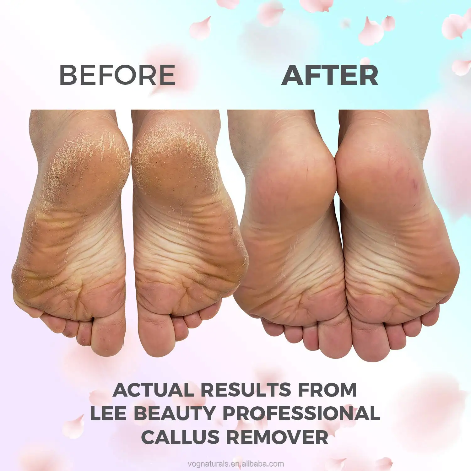 Unique Bargains Abs Stainless Steel 304 Tpr Removes Dead Skin Foot