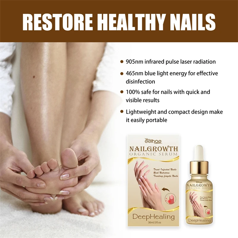 Eelhoe 30ml Deep Healing Nail Growth Organic Serum Onychocryptosis