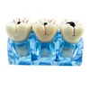 Dental Decayed Teeth Model