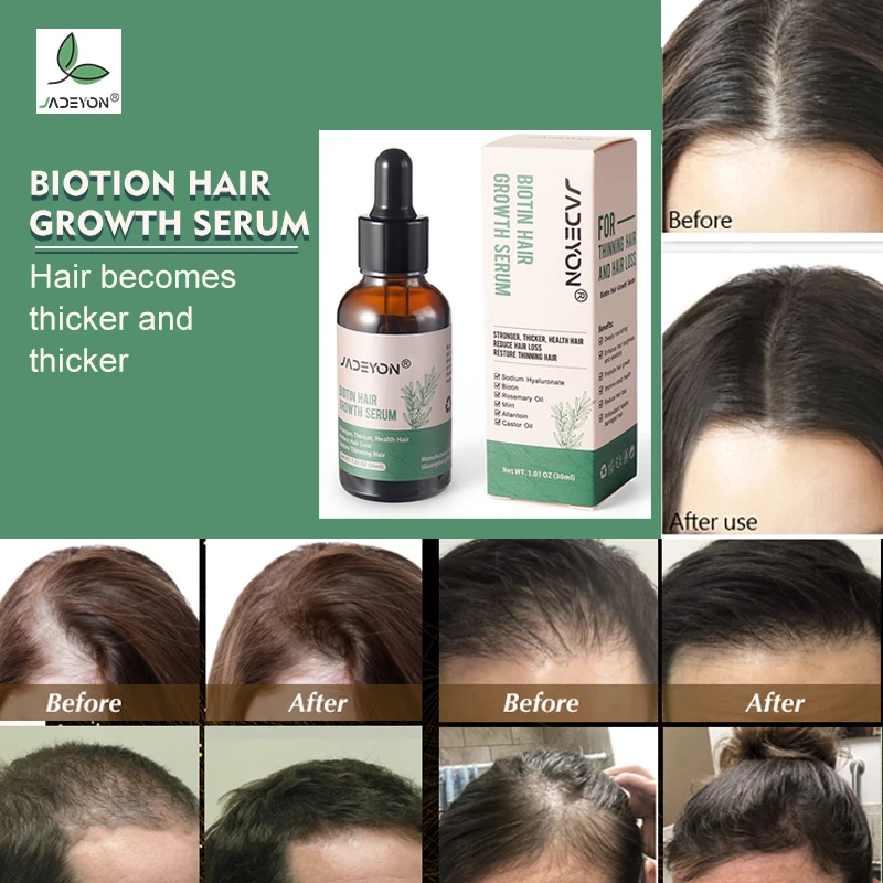 Private Label Natural Castor Oil For Hair Serum Anti Loss Regrowth For