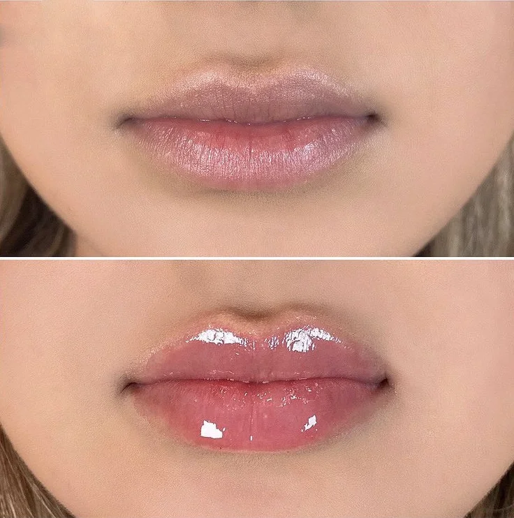 Popular Lip Care Gel Vitamin C Lip Plumper Private Label