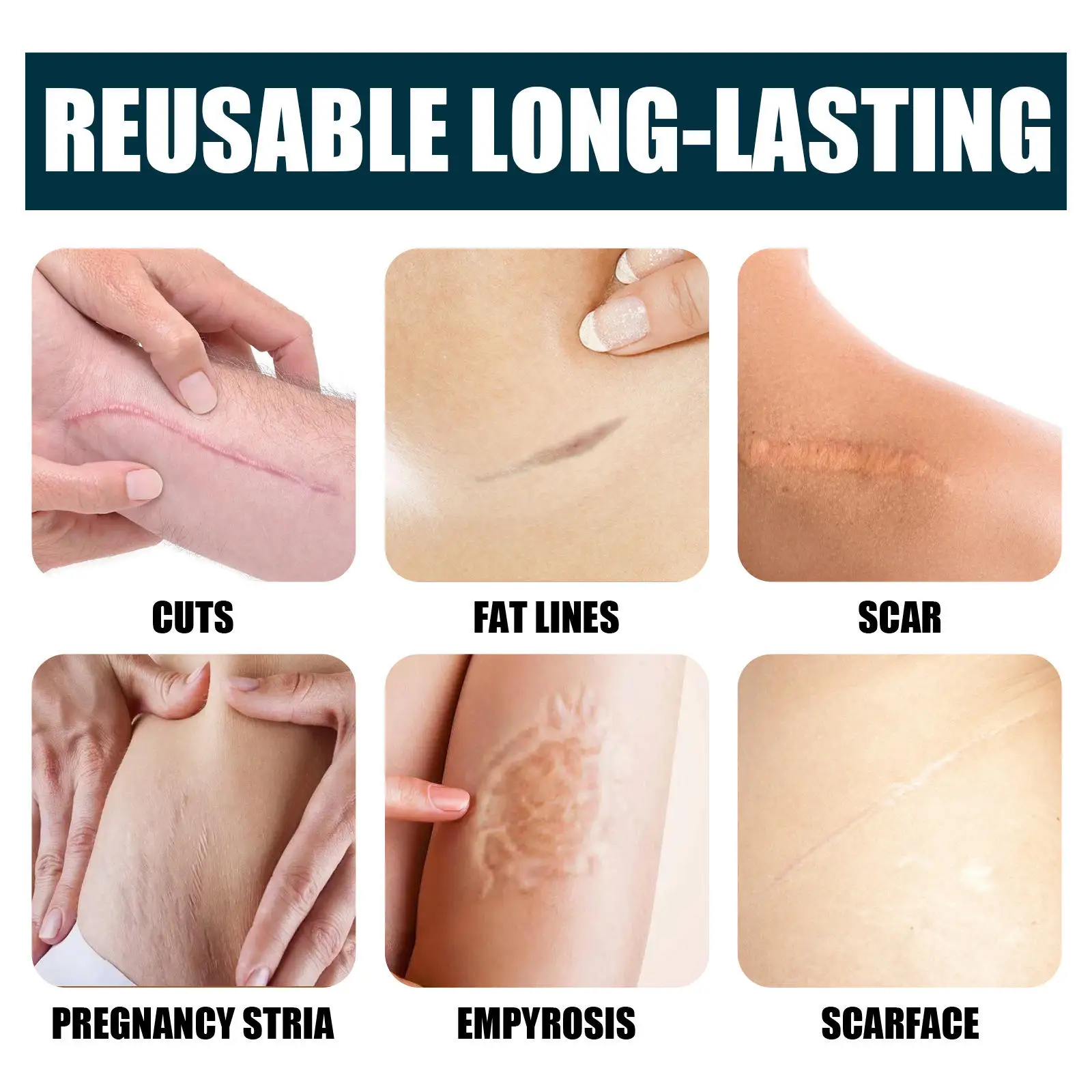 Wholesale Scar Gels for Beauty & Personal Care Lightening Acne Marks Removing Surgical Scars Repairing Scars