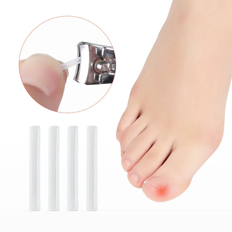 Ingrown Toenail Tool Ingrown Toenail Corrector Pad 10 Pcs Straightener Clip Pedicure Tools Toe Nail Care Protects Toe