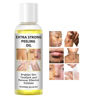 Hot Sale Extra Strong Peeling Oil Scar Remove Stretch Marks Whitening Yellow Peeling Oil