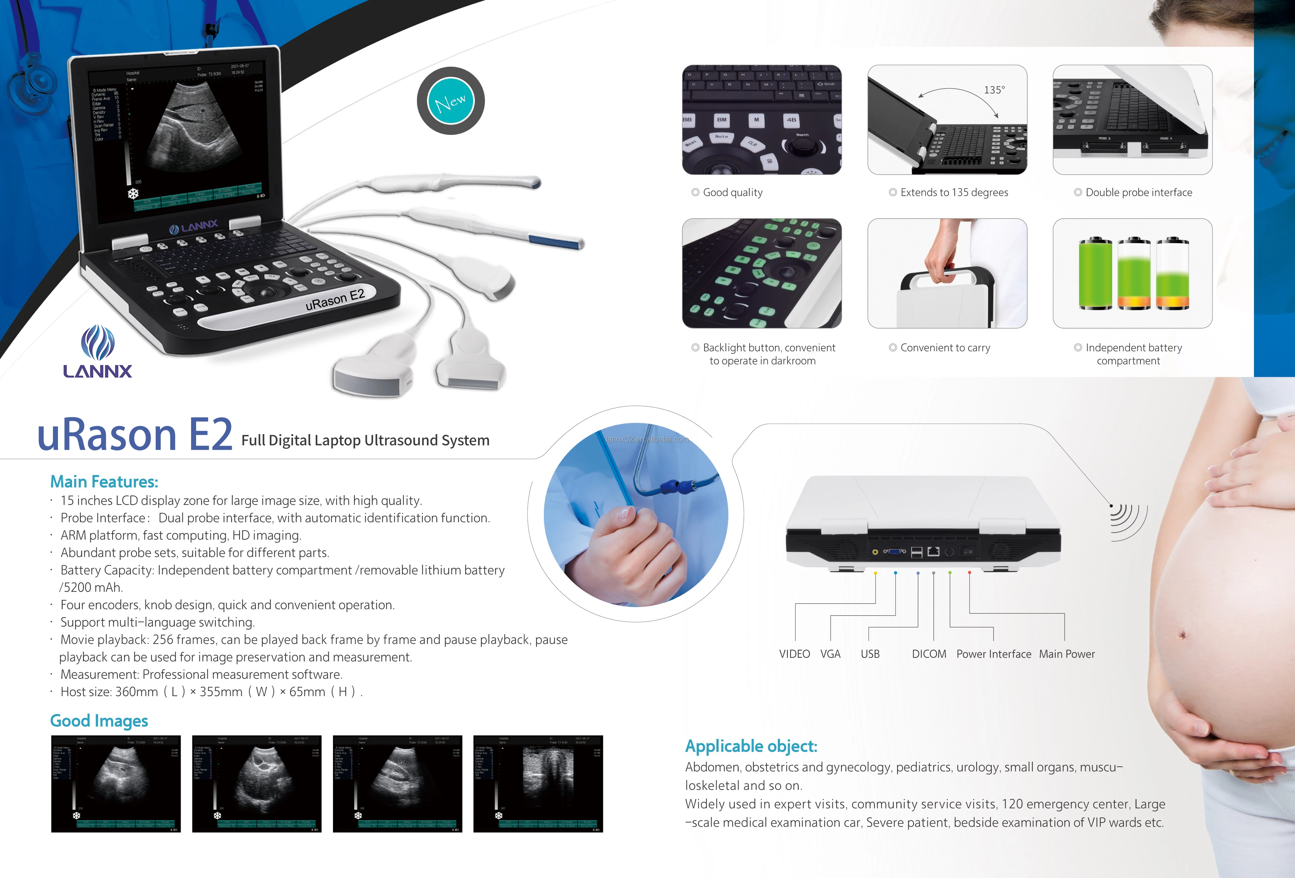 Lannx Urason E2 Clinic Handheld Ultrasound Imaging Detector Machine ...