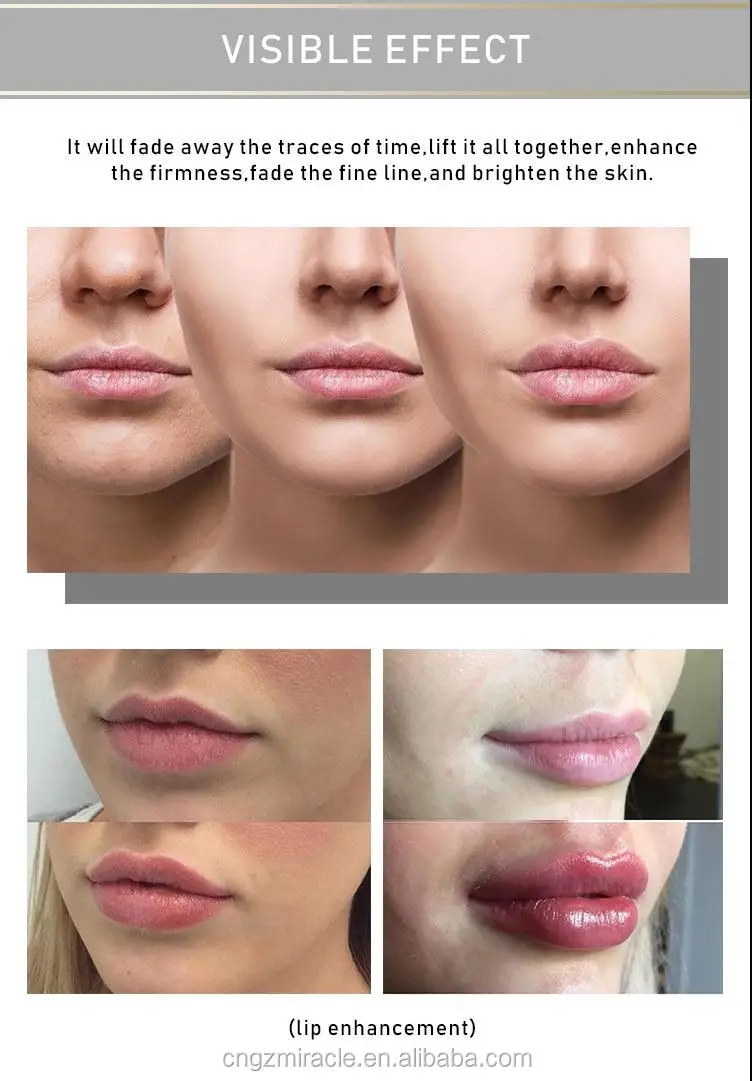 hyaluronic pen test