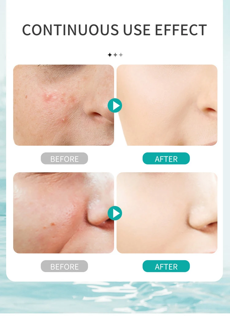 ESTELIN Deep Cleansing Hydrating Hyaluronic Acid Facial Cleanser 80g