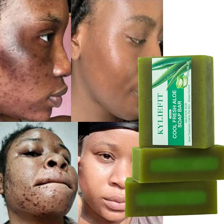 gesichtsspray aloe vera Aloe Vera Spray aus der Apotheke main image 0