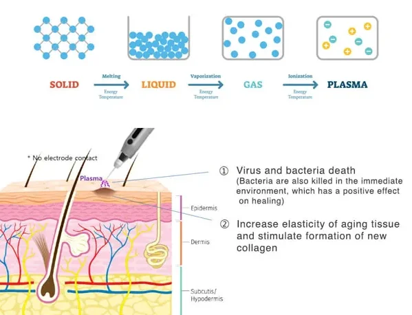 New products professional plasma pen fibroblast wrinkles removal plaxel plasma pen korea