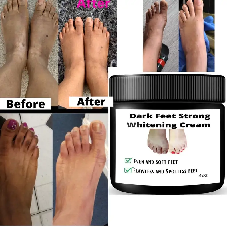 Dark Feet Whitening Cream Fast Action Extreme Whitening Cream For Dark