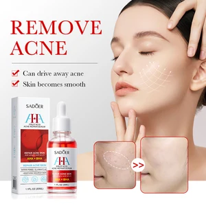OEM SADOER alpha hydroxy acids acne removal control oil moisturize acne niacinamide skin care serum