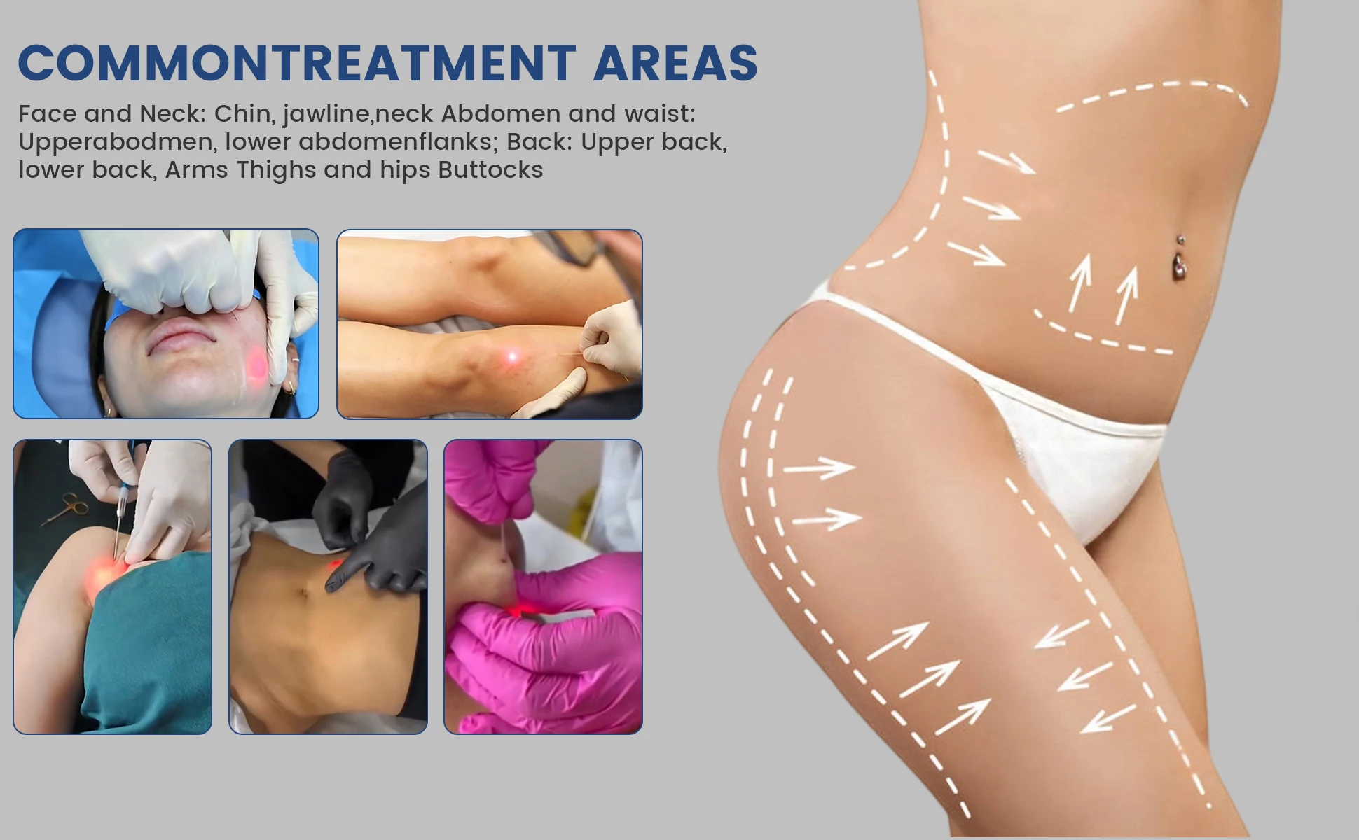 Common Care Areas