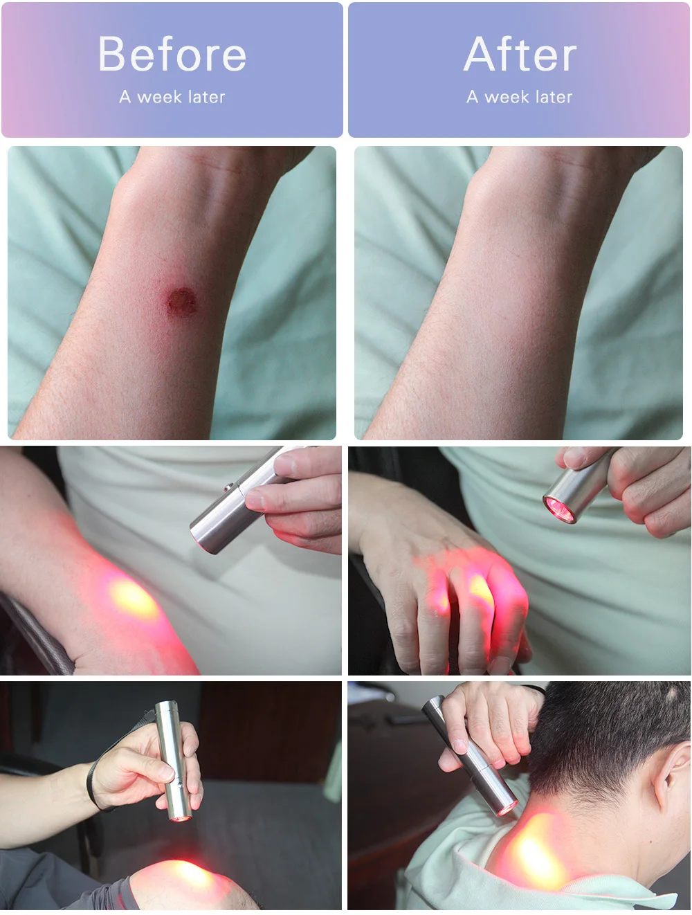 Ideatherapy Torch Red Light Therapy Pen 630nm 660nm 850nm 3 Color Led ...