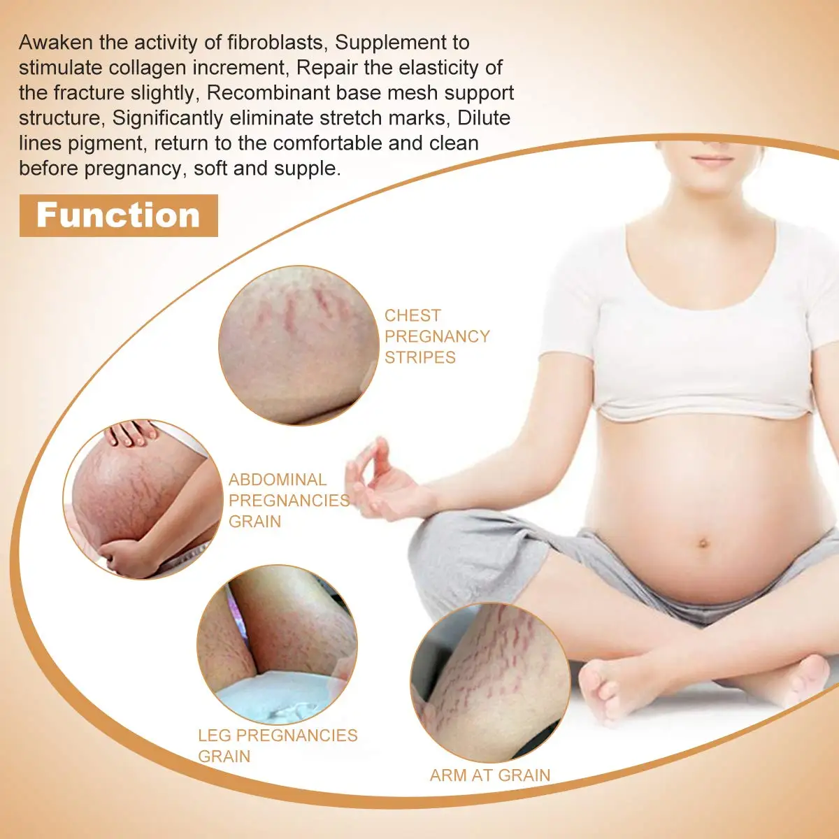 Private Label stretch mark removing cream for pregnancy moisturizing nourishing and fading scar marks