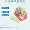 A dental implant white bottom white nail