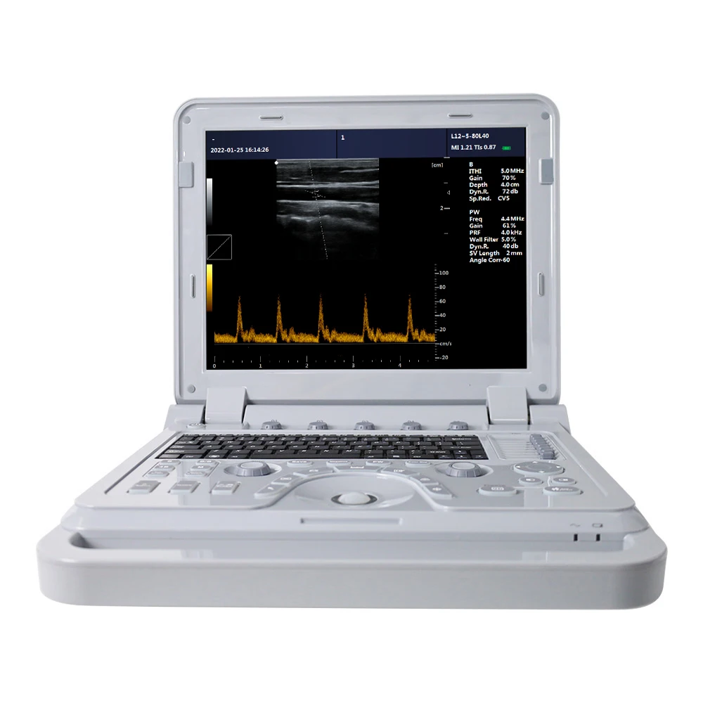 Contec Cms600p2vet Doppler Ultrasound Equipment Medical Equipment ...