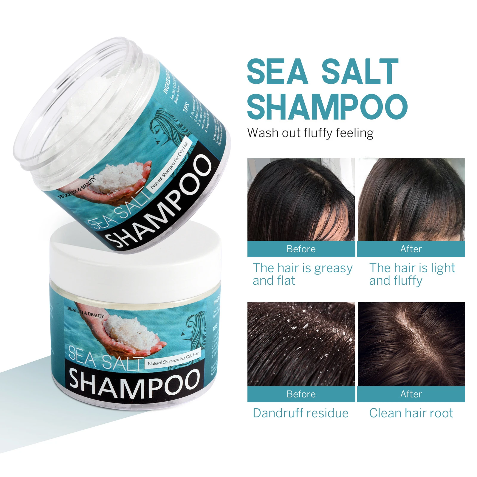 Effectively Anti-dandruff Refreshing Oil Control To Remove Dandruff  Soothing Clean Hair Follicle Sea Salt Shampoo - Buy Shampoo,Sea Salt Shampoo,Remove  Dandruff Shampoo Product on 