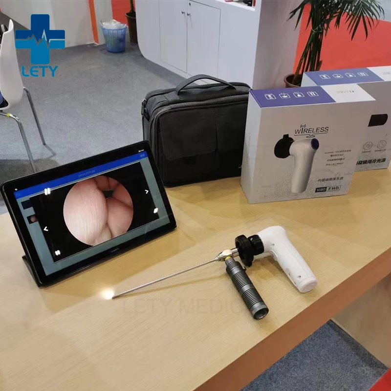 Wireless HD Endoscope Camera System for ENT Departments ENT Endoscope