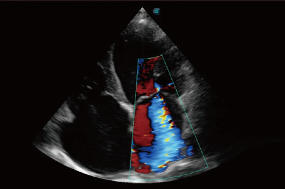 Sonoscape P20 Mobile 3D/4D Real-time Color Panoramic Doppler Trolley Ultrasound Machine supplier