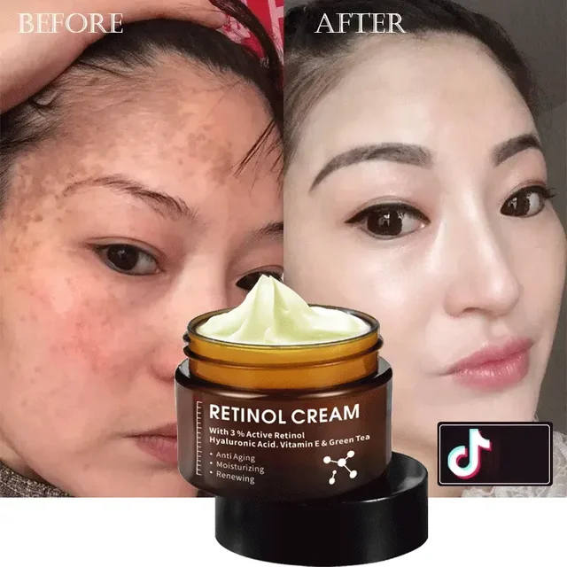 High quality freckle cream Anti Aging Wrinkle Removal Dark Spot Strong bleaching whitening Collagen retinol vitamin c face cream