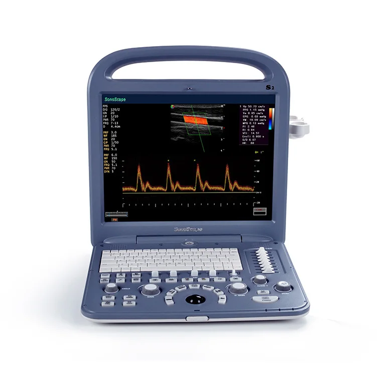Best quality Sonoscape S2 Medical Ultrasound Instruments Portable Color Ultrasound Doppler 3d 4d for hospital for sale