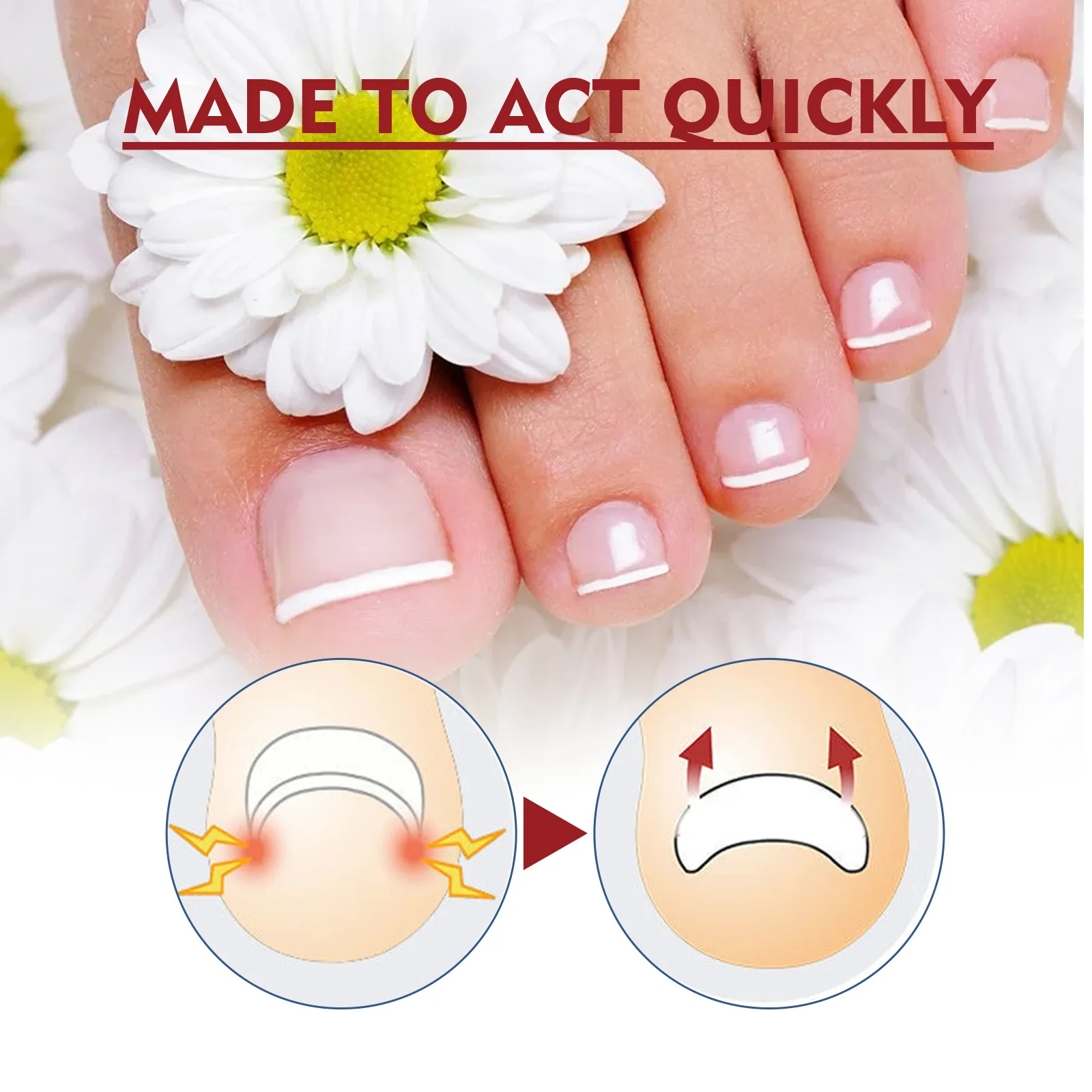 Nail Renewal Extra Strength Fungus Toe Fingernails Repair Liquid Renew Damaged Broken Nail 7 Days Nail Fungus Treatment