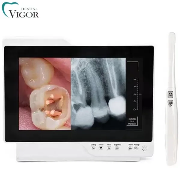 Digital Intraoral Endoscopy Camera With Monitor for Dental Chair Dental Inter Oral Endoscopy