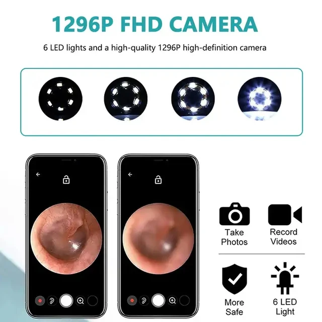 Wifi Visual Ear Spoon Mini 1080p Hd Camera 3.5mm 5mp Electric Ear Wax Removal Cleaner - Image 4