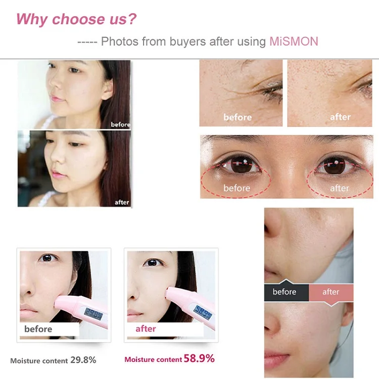 Mismon CE 5 in 1 Microcurrent Near Infrared Light Skin Care Device