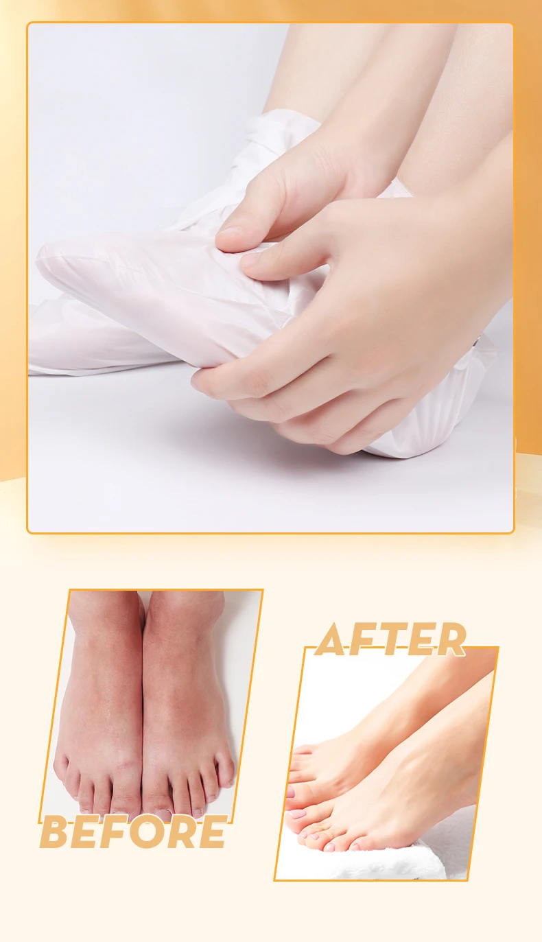 改善死皮羊奶足膜滋养修复足膜 Buy 足部面膜 足部面膜去角质去角质足部面膜美容足部去角质剥离面膜足部剥离掩模足部去角质 足 部面膜脚peeleing面具足部皮肤护理足部面膜去角质足部面膜
