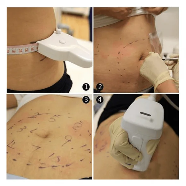 LIPO-