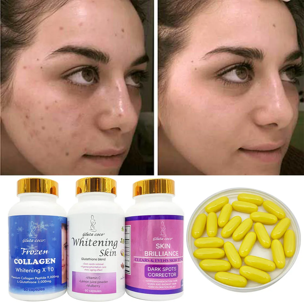 glutathione pastillas para aclarar la piel Blanquear Con Glutation Thiocell Glutatin Pastillas Aclarar Piel