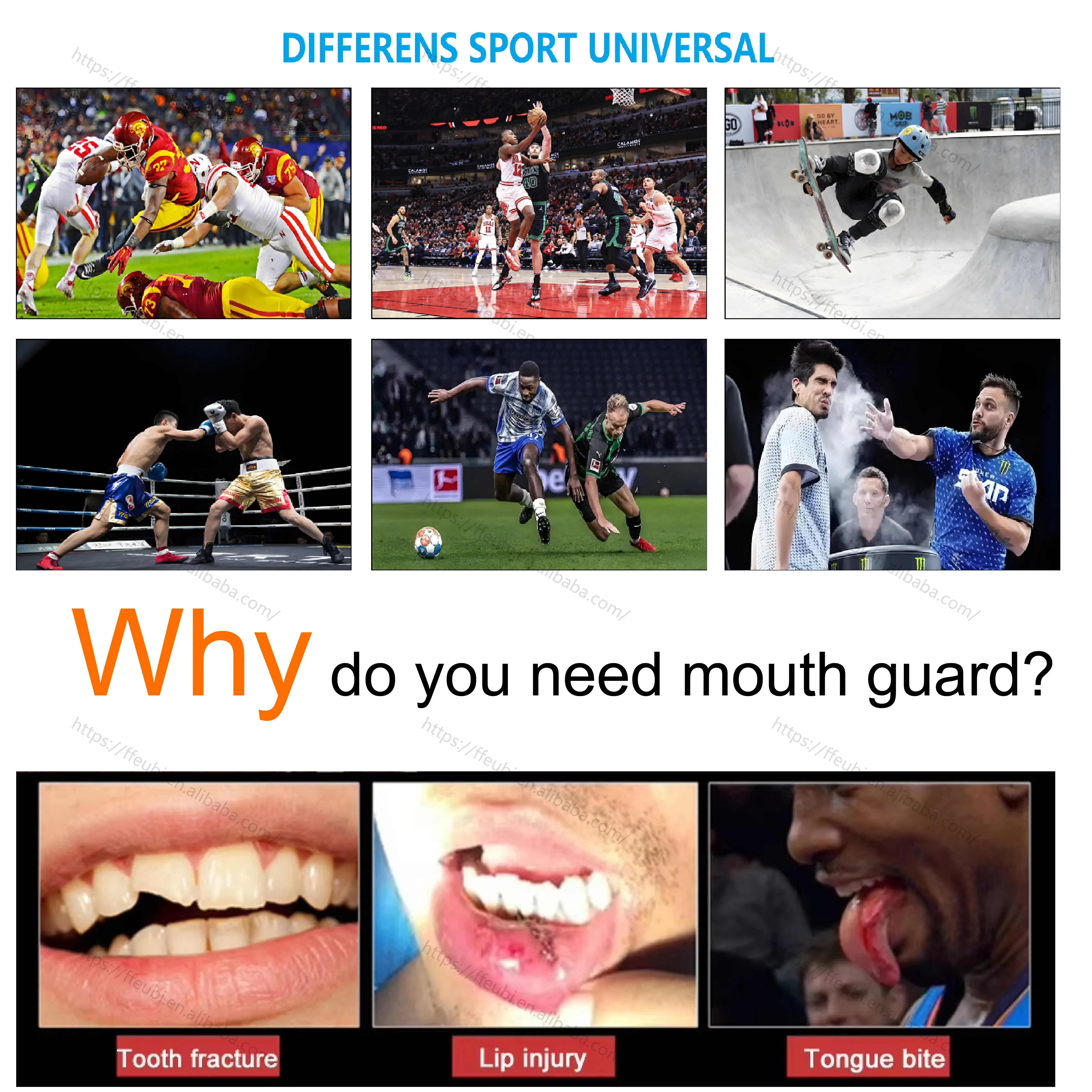 Custom Print Logo Sports Boxing Rugby Mouthpiece Mouth Guard