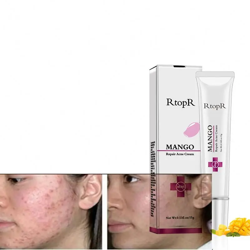 fast acne scar removal cream