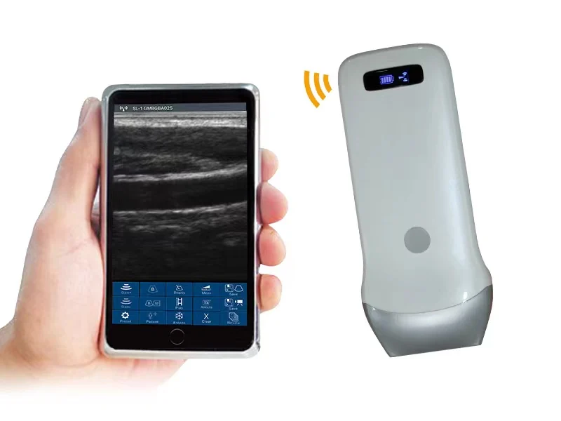 Best Selling Portable Wireless Linear Probe Ultrasound Scanner Hospital Equipment Linear Scanner Machine Scanner Price