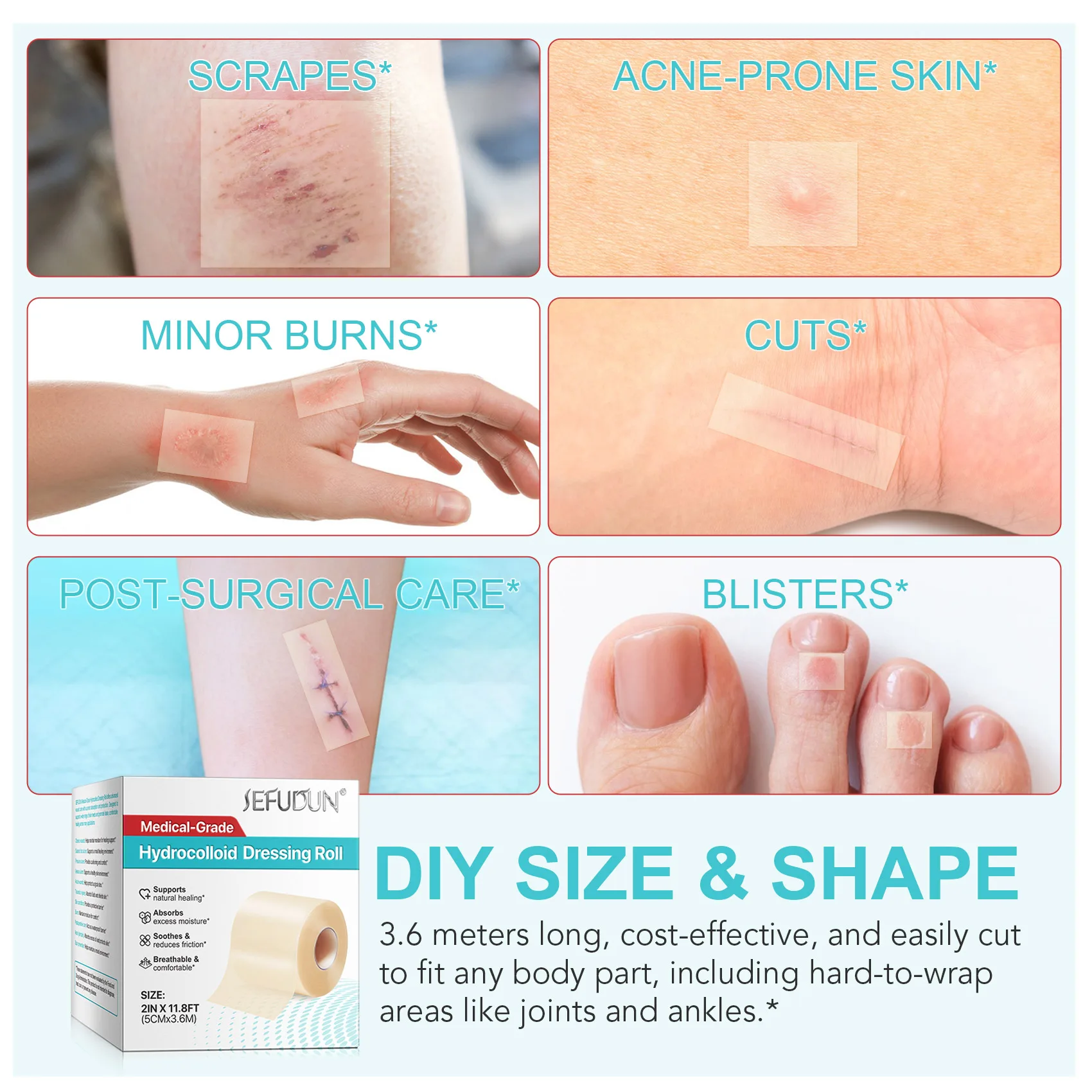 hydrocolloid dressing for burns How To Use A Hydrocolloid Dressing... Properly! - Blister Prevention main image 0