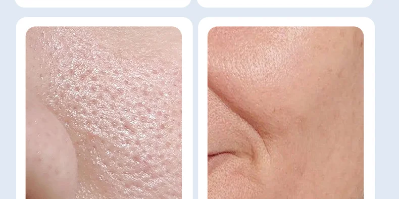 Retinol Moisturizer for Anti-Aging - Moisturizes & Improves Skin Elasticity Suitable for All Skin(pic7)