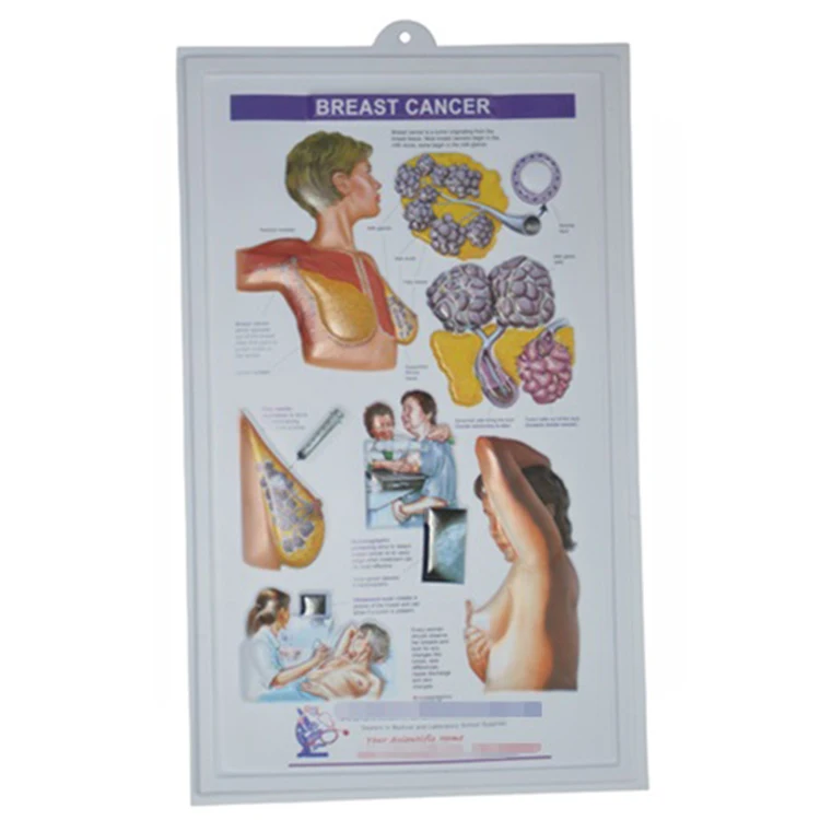 Образовательный пластиковый тисненый медицинский плакат, 3D медицинская анатомическая настенная диаграмма