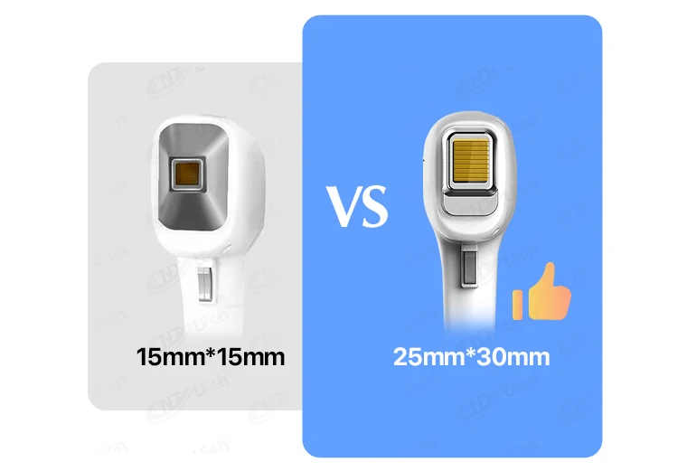 CNVレーザー脱毛 レーザー脱毛,レーザー脱毛